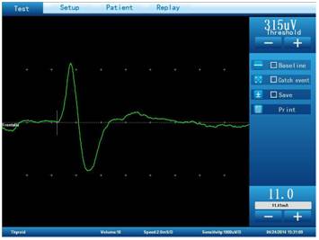 test monitoring